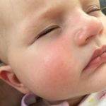 Allergies: Tips On How To Cope & Lead A Normal Life