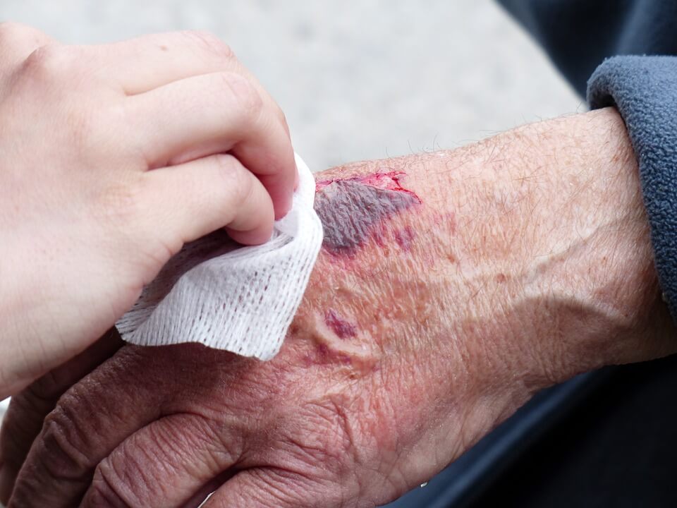 3 Ways To Best Help An Injured Loved One